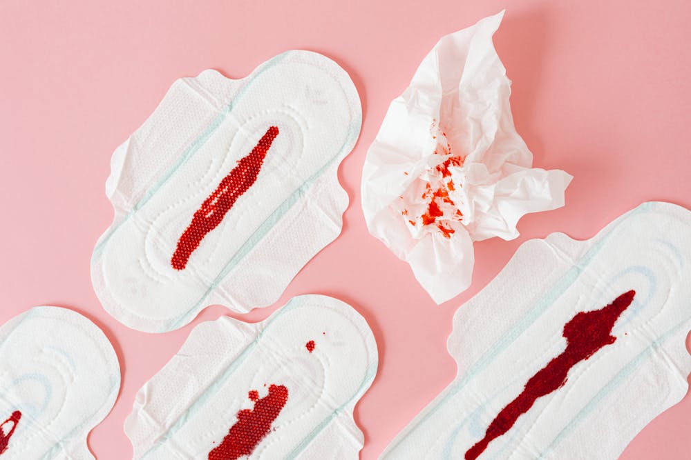 Pads for menorrhagia: Four menstrual pads with red blood stains and a crumpled tissue with blood on a pink background.
